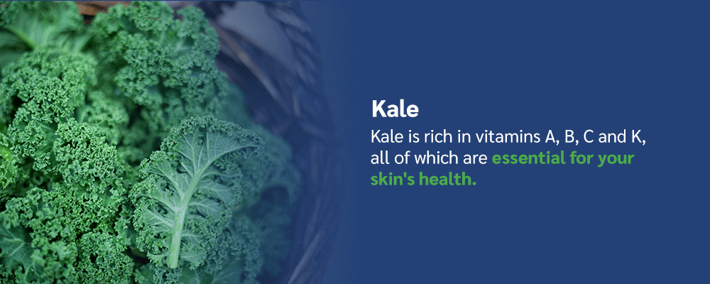 Kale