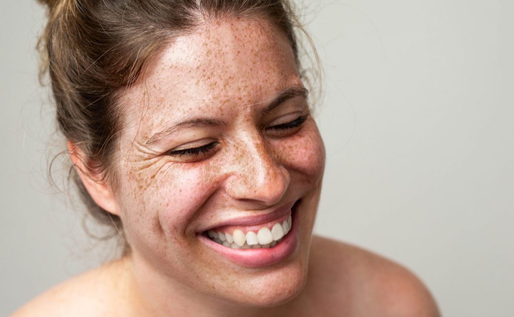 a woman with freckles on her face smiles with her eyes closed