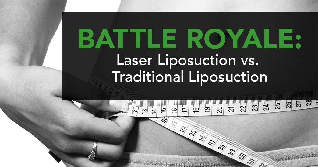 Battle Royale: Laser Liposuction vs. Traditional Liposuction