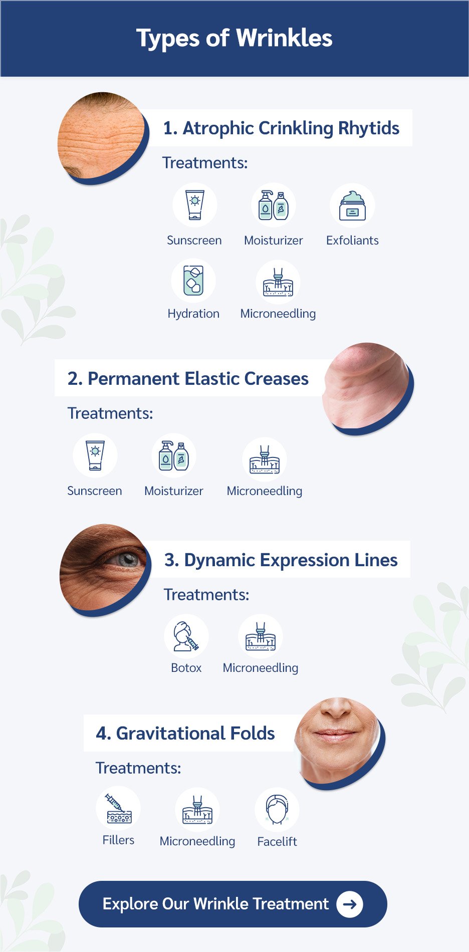 A list of the types of wrinkles