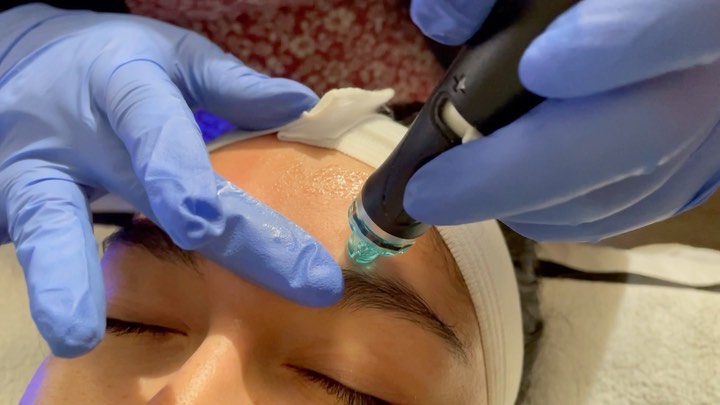 a person wearing blue gloves is getting a treatment on their face