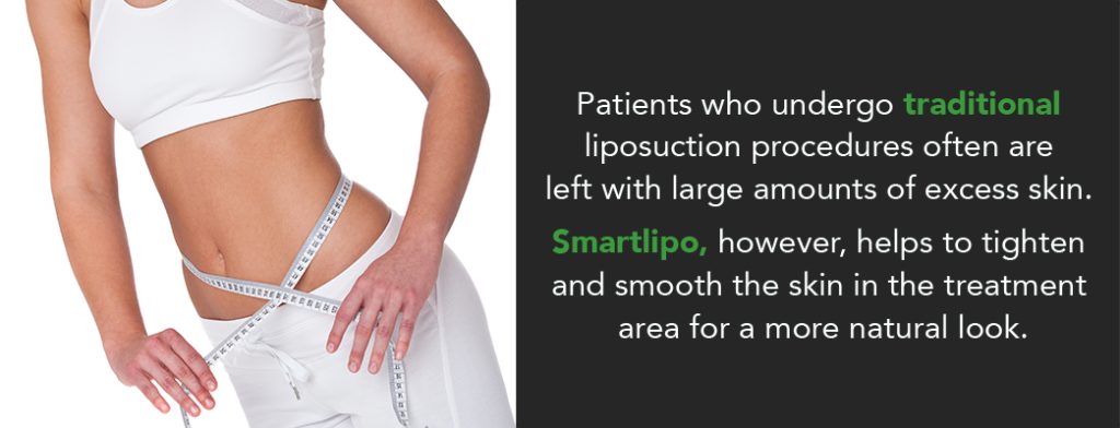 Swelling After Liposuction: How Long and How to Reduce It