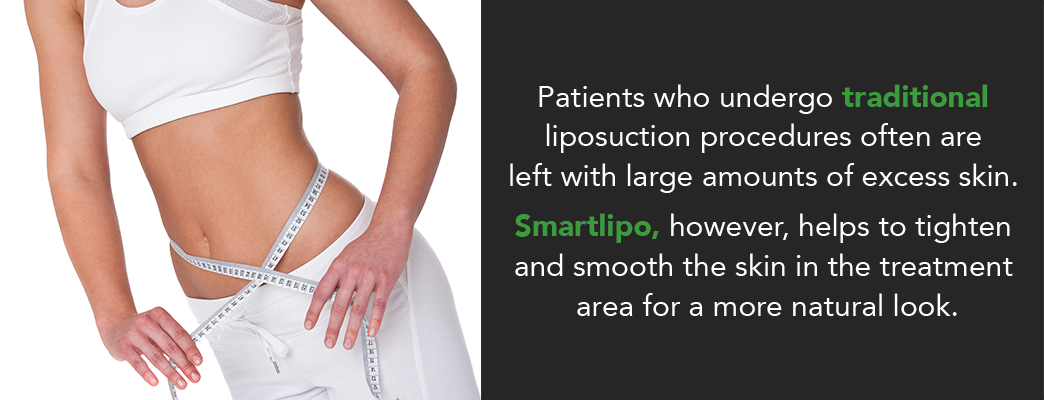 Traditional Liposuction Vs. Laser Liposuction: What's The Difference? -  Hinsdale Vein & Laser