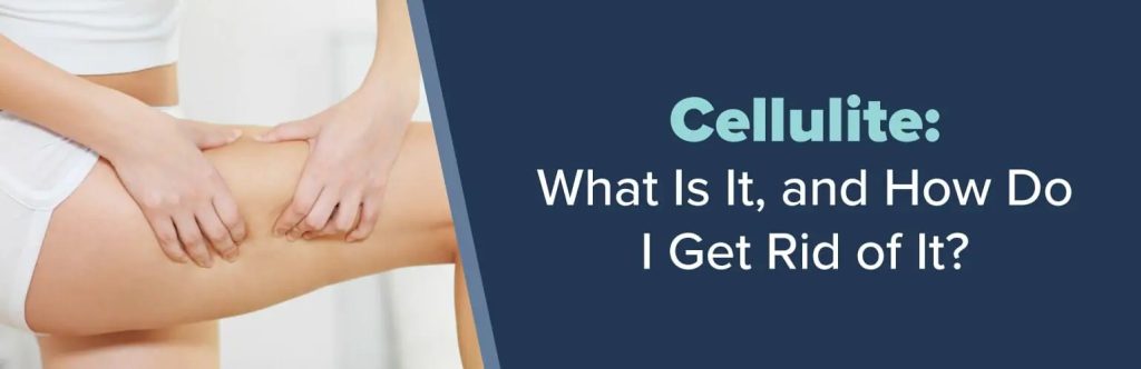 a woman is holding her leg with the words cellulite what is it and how do i get rid of it
