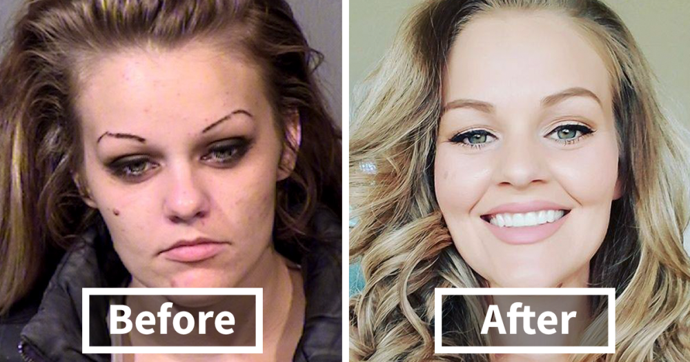 before and after photos of a woman who went through drug addiction rehab