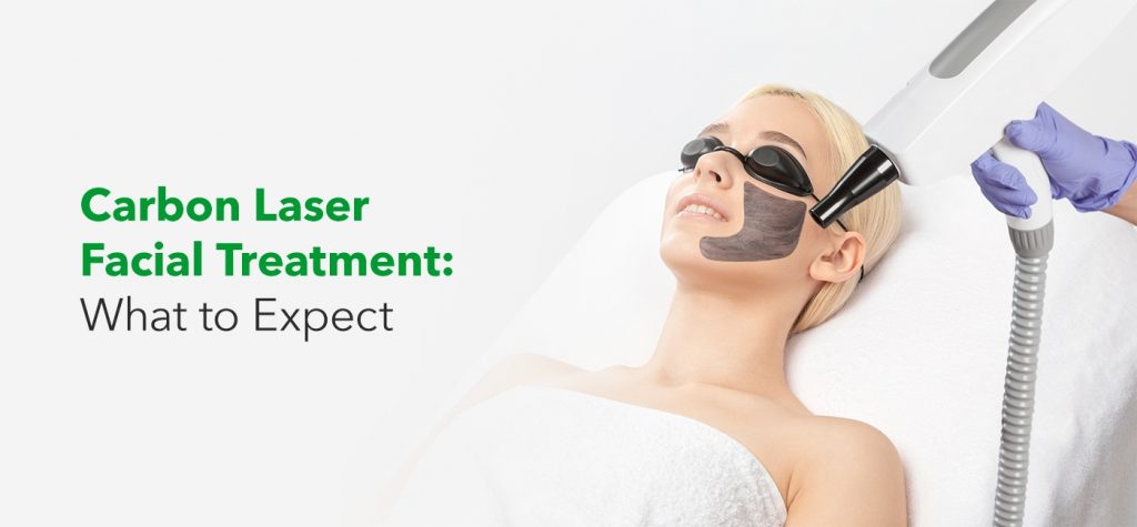 Carbon Laser Facial Treatment: What to Expect