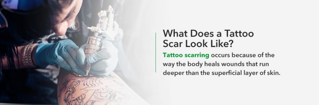 What Does a Tattoo Scar Look Like?