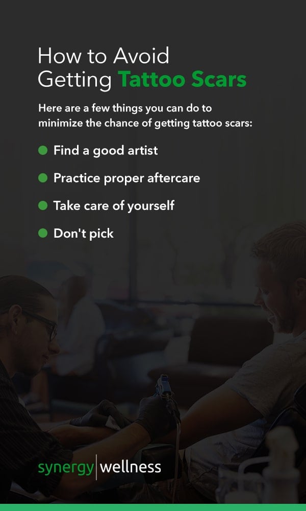 How to Avoid Getting Tattoo Scars