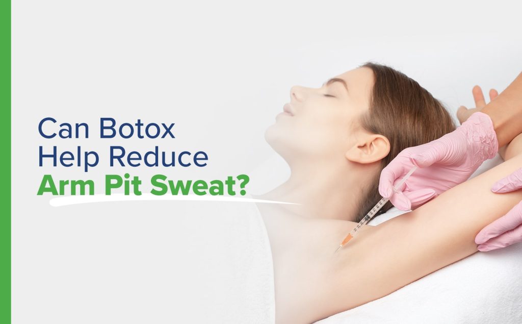 Can Botox Help Reduce Arm Pit Sweat?