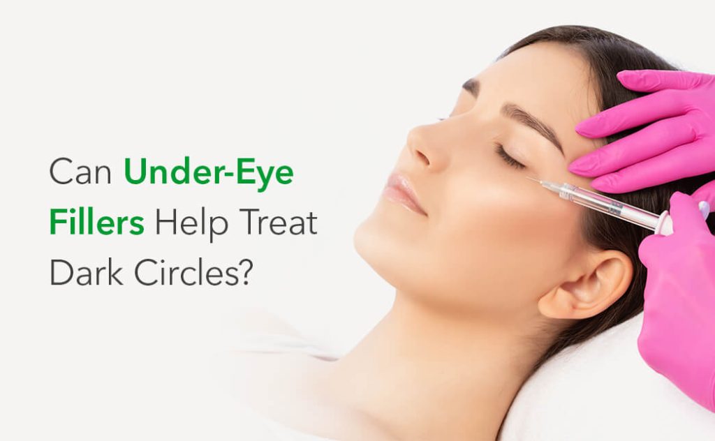 Can Under-Eye Fillers Help Treat Dark Circles?