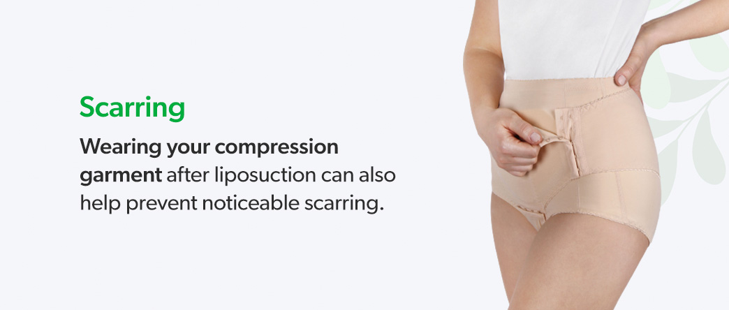 The compression garment is removed two days after surgery to take