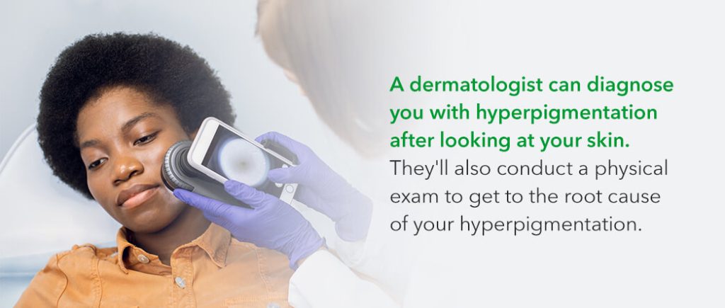 How Is Hyperpigmentation Diagnosed?