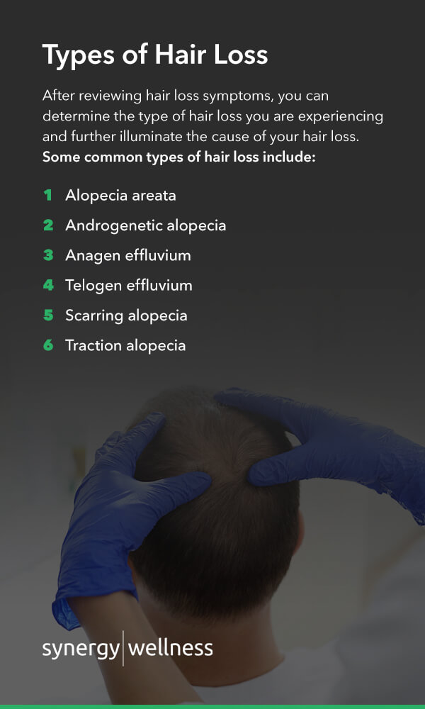 Types of Hair Loss