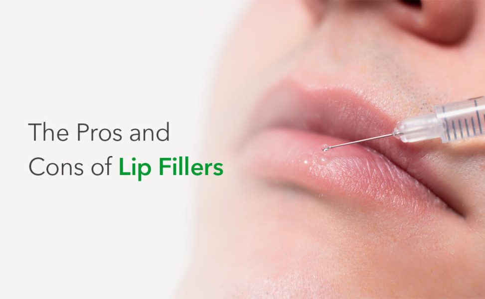 The Pros and Cons of Lip Fillers Synergy Wellness