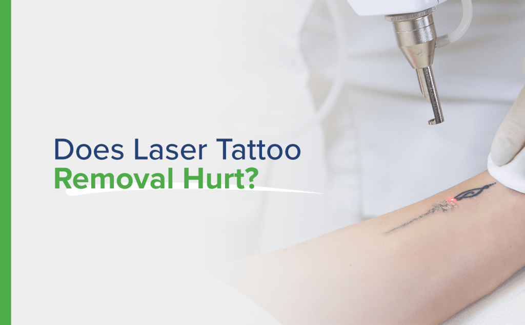 does laser tattoo removal hurt?
