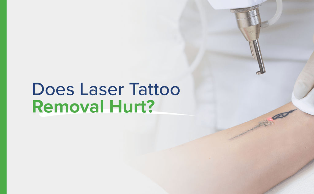 An expert's explanation of laser tattoo removal | Top Doctors