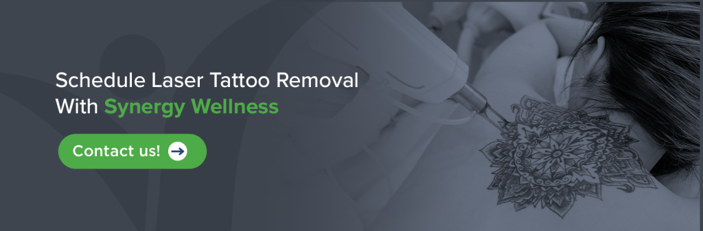 schedule laser tattoo removal with Synergy Wellness